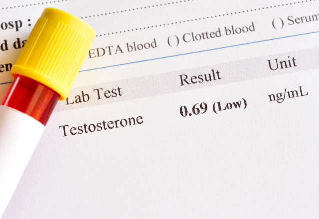 Testosterone result test