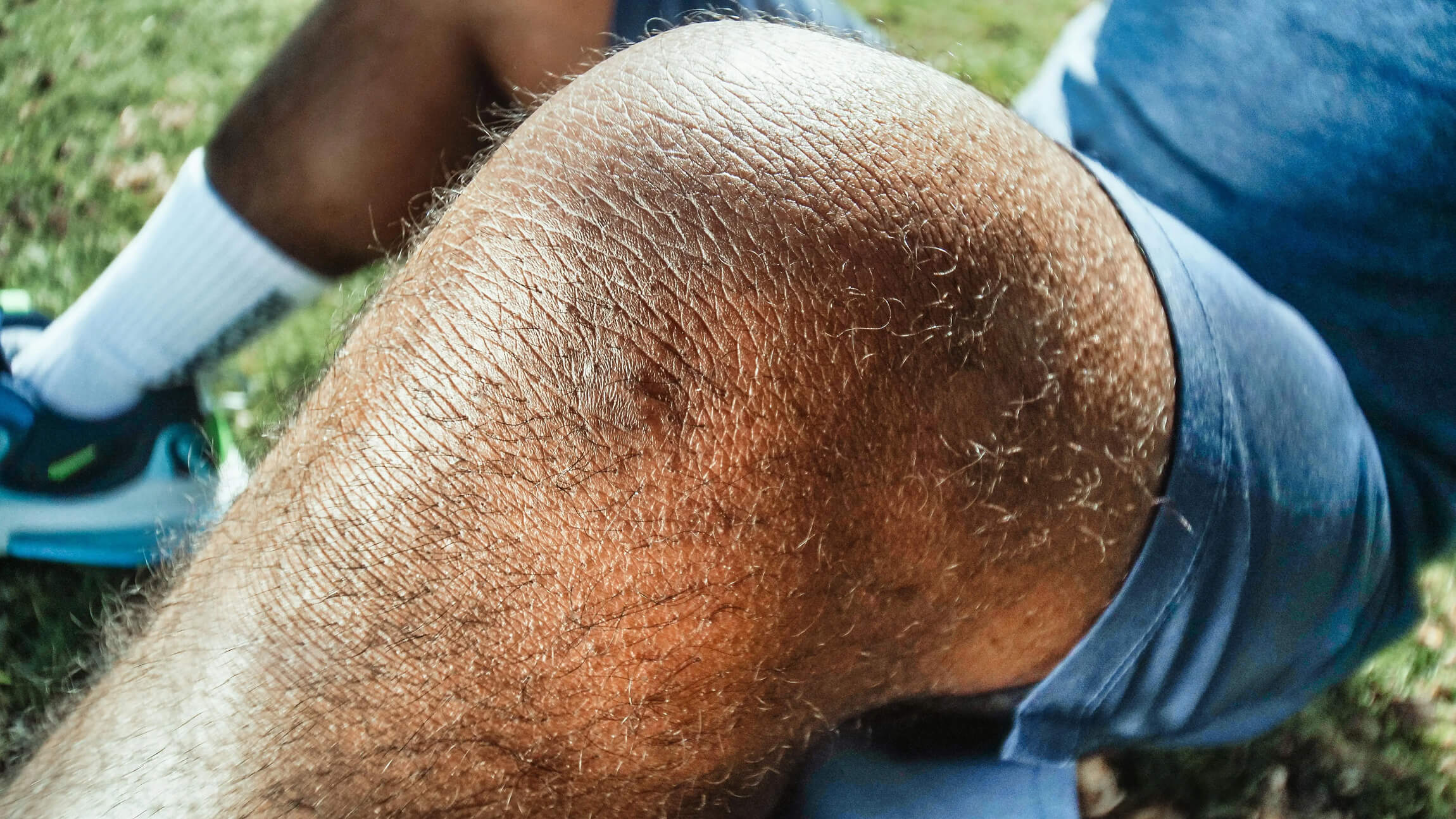 Close up a of a knee