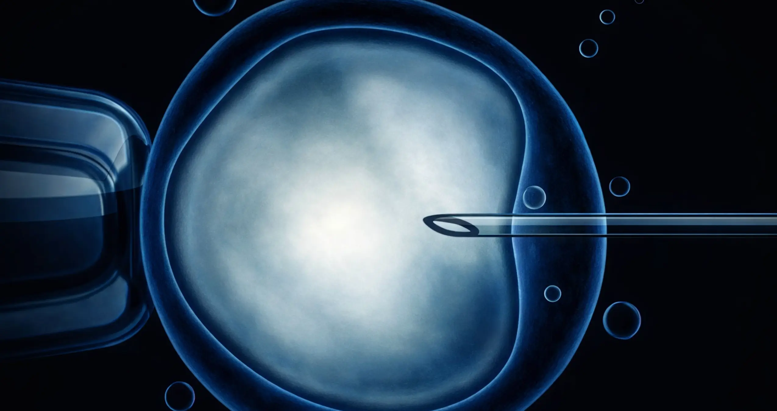 Intracytoplasmic Sperm Injection